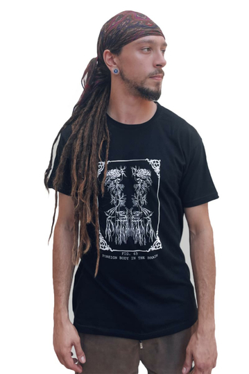 Foreign Body In The Brain T-shirt Black